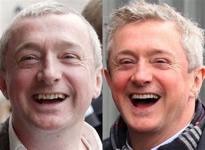 Discover The Surprising Truth About Actors With The Worst Teeth